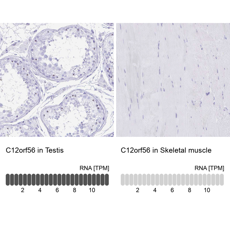Anti-C12orf56 Antibody