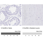 Anti-C12orf56 Antibody