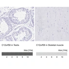 Anti-C12orf56 Antibody