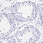Immunohistochemical staining of human testis shows moderate positivity in nucleoli in cells in seminiferous ducts.