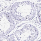 Immunohistochemical staining of human testis shows moderate positivity in nucleoli in cells in seminiferous ducts.