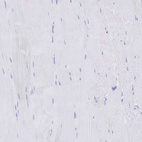 Immunohistochemical staining of human skeletal muscle shows no positivity in myocytes as expected.