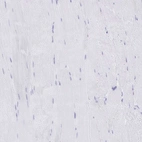 Immunohistochemical staining of human skeletal muscle shows no positivity in myocytes as expected.
