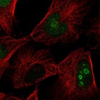 Anti-FAM3A Antibody