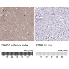 Anti-PGM2L1 Antibody