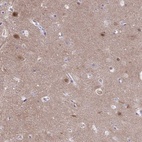 Immunohistochemical staining of human cerebral cortex shows high expression.