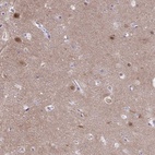 Anti-PGM2L1 Antibody