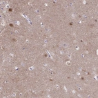 Immunohistochemical staining of human cerebral cortex shows high expression.