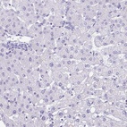 Anti-PGM2L1 Antibody