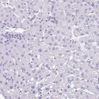 Immunohistochemical staining of human liver shows low expression as expected.