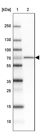 Lane 1: Marker [kDa] 250, 130, 100, 70, 55, 35, 25, 15, 10_br/_Lane 2: Human Cerebral Cortex tissue