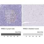 Anti-RRM2 Antibody