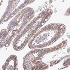 Immunohistochemical staining of human Duodenum shows moderate cytoplasmic and membranous positivity in glandular cells.