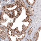 Immunohistochemical staining of human prostate shows strong membranous positivity in glandular cells.