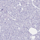 Anti-RRM2 Antibody