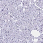 Immunohistochemical staining of human Pancreas shows no positivity in exocrine glandular cells as expected.