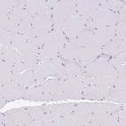 Anti-RRM2 Antibody