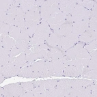 Immunohistochemical staining of human Skeletal muscle shows no positivity in myocytes as expected.