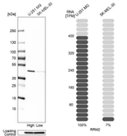 Western blot analysis in human cell lines U-251MG and SK-MEL-30 using Anti-RRM2 antibody. Corresponding RRM2 RNA-seq data are presented for the same cell lines. Loading control: Anti-PPIB.