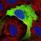 Immunofluorescent staining of human cell line U-2 OS shows localization to cytosol.