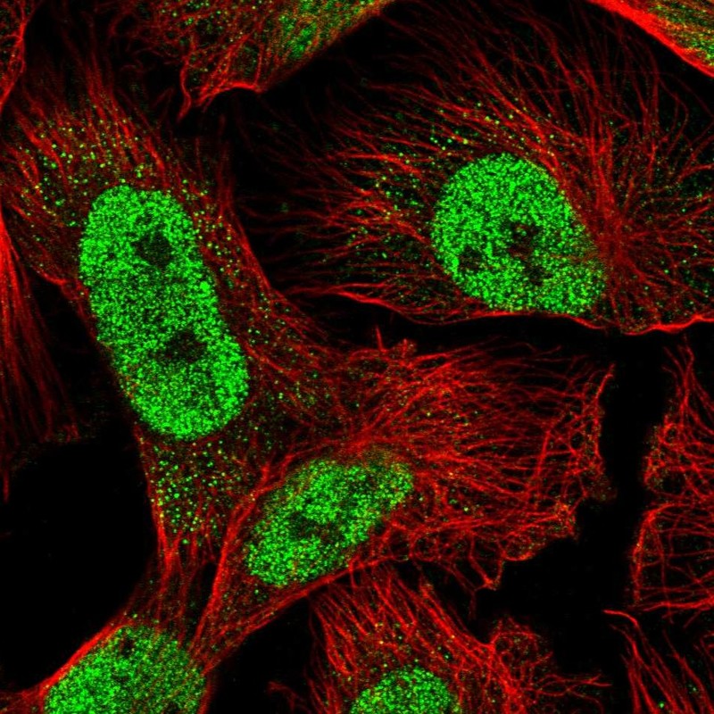 Anti-RAD23A Antibody