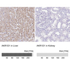 Anti-AKR1D1 Antibody