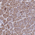 Anti-CCDC85A Antibody