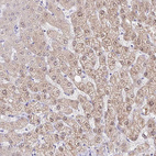 Immunohistochemical staining of human liver shows moderate cytoplasmic positivity in hepatocytes.