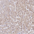 Immunohistochemical staining of human liver shows moderate cytoplasmic positivity in hepatocytes.