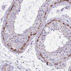 Anti-GRK4 Antibody