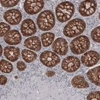 Immunohistochemical staining of human colon shows strong membranous positivity in glandular cells.