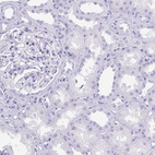 Immunohistochemical staining of human kidney shows no positivity in cells in tubules as expected.