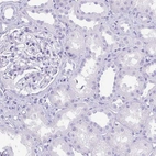 Immunohistochemical staining of human kidney shows no positivity in cells in tubules as expected.