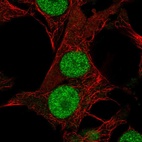 Immunofluorescent staining of human cell line SK-MEL-30 shows localization to nucleoplasm.