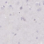Immunohistochemical staining of human cerebral cortex using Anti-CSN1S1 antibody HPA057031.