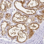 Immunohistochemical staining of human lactating breast using Anti-CSN1S1 antibody HPA057031.