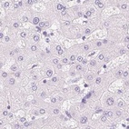 Anti-CSN1S1 Antibody