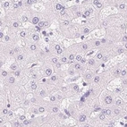 Immunohistochemical staining of human liver using Anti-CSN1S1 antibody HPA057031.
