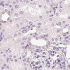 Immunohistochemical staining of human kidney using Anti-CSN1S1 antibody HPA057031.