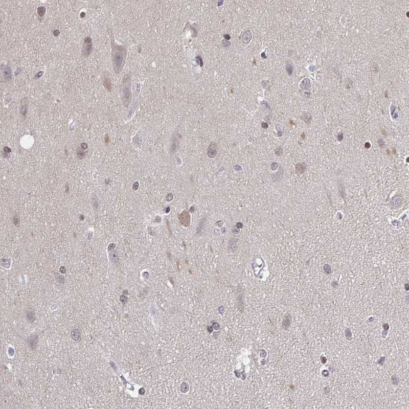 Anti-SLC7A10 Antibody