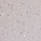 Anti-SLC7A10 Antibody