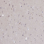 Anti-SLC7A10 Antibody