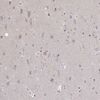 Anti-SLC7A10 Antibody