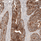 Anti-CLDN3 Antibody