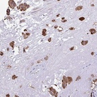 Anti-PIGK Antibody