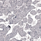 Immunohistochemical staining of human placenta shows no positivity in trophoblastic cells as expected.