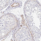 Anti-TSPAN19 Antibody