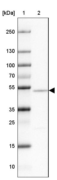 Anti-NAP1L2 Antibody