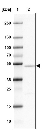 Anti-NAP1L2 Antibody