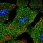 Anti-NAP1L2 Antibody